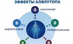 Дешевые и доступные заменители Алфлутопа: ТОП 13 аналогов