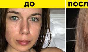 Эксперимент на себе! Отказалась от молочных продуктов, как это отразилось на состоянии кожи?