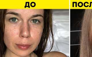 Эксперимент на себе! Отказалась от молочных продуктов, как это отразилось на состоянии кожи?