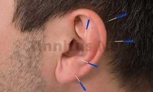 Народная медицина против шума в ушах