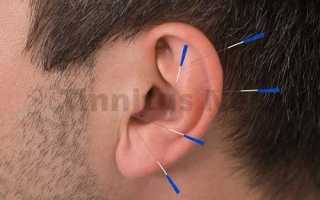 Народная медицина против шума в ушах