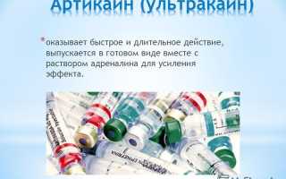 Отзывы о применении лекарства Артикаин в стоматологии и инструкция к препарату