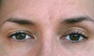 Верхнее веко теряет упругость? 5 минут в день и кожа лица вернет утраченную молодость