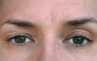 Верхнее веко теряет упругость? 5 минут в день и кожа лица вернет утраченную молодость