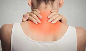 Отложение солей в шейном отделе: эффективные методы лечения