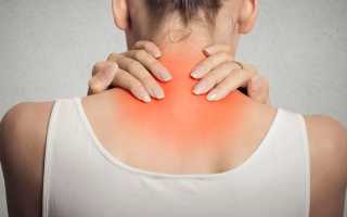 Отложение солей в шейном отделе: эффективные методы лечения