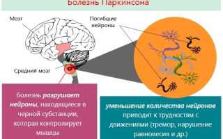 Инструкция по применению новейшего препарата современности Азилект и его аналоги