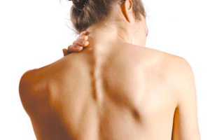 Польза и противопоказания ЛФК при остеохондрозе шейного отдела