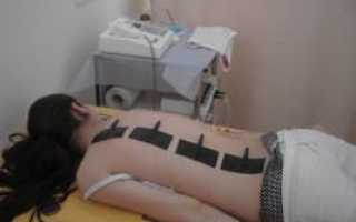 Спондилоартроз пояснично-крестцового отдела позвоночника