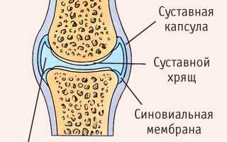 Причины скопления жидкости в коленном суставе и методы ее устранения