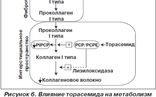 Чем отличается препарат Фуросемид от Торасемида и какой из них лучше?