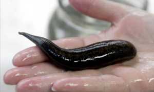 Лечебные пиявки: польза и вред нетрадиционного метода избавления от различных заболеваний