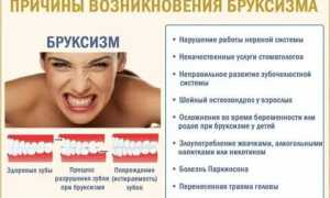 Бруксизм: опасная болезнь или пагубная привычка
