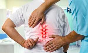 Медики рассказали, как уберечь свой позвоночник от болезней