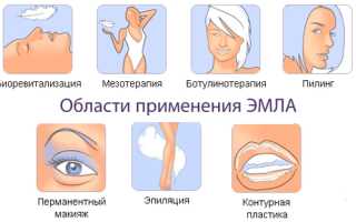 Инструкция по применению крема Эмла и цена