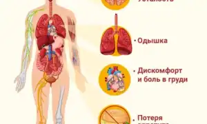 Признаки сердечной недостаточности: о них стоит знать всем