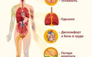 Признаки сердечной недостаточности: о них стоит знать всем