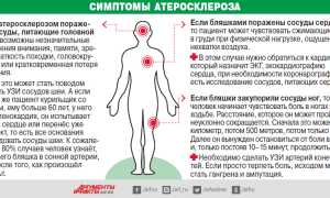 Основные симптомы забитых артерий