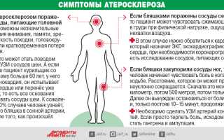 Основные симптомы забитых артерий