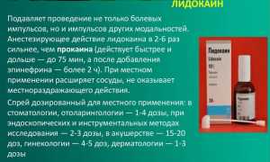 Инструкция по применению спрея Лидокаин и его аналоги