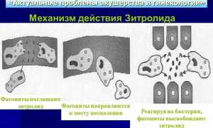ТОП 12 дешевых аналогов препарата Вильпрафен: зарубежные и российские заменители