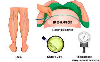 Гипертонус матки при беременности: симптомы и лечение