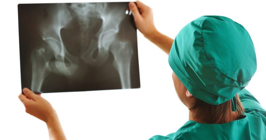 Рентгенограмма