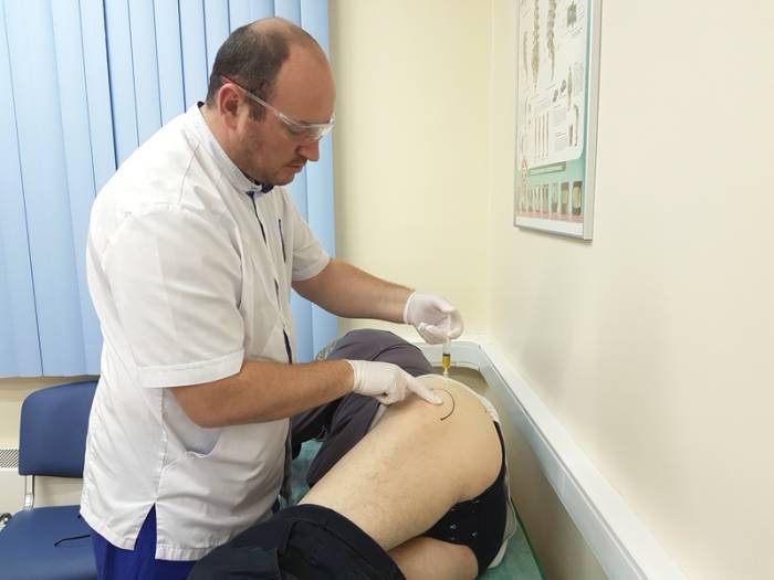 Инъекция при коксартрозе