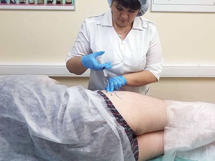 Инъекция при коксартрозе