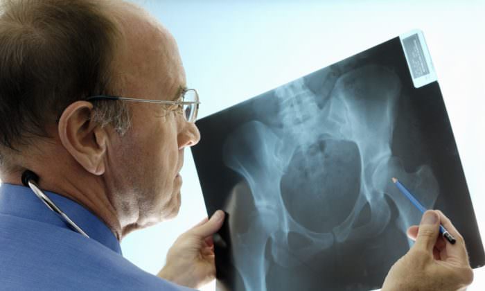 Рентгенография тазовых костей