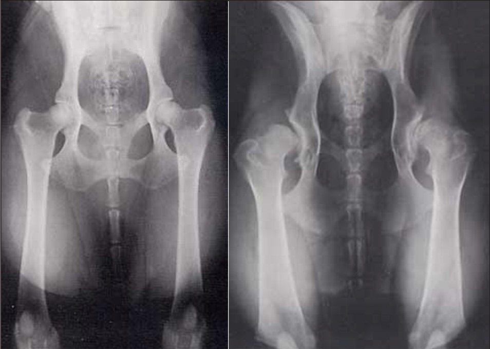 Рентгеновский снимок