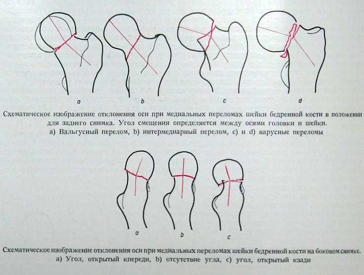 Рисунок
