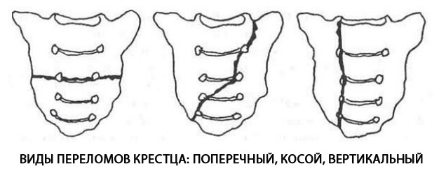 Рисунок