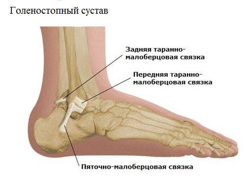 артрит голеностопного сустава