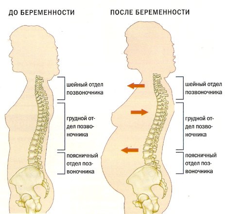 позвоночник при беременности
