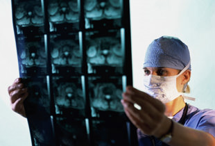 деформирующий остеоартроз