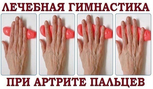 Лечебная гимнастика для артрита пальцев рук