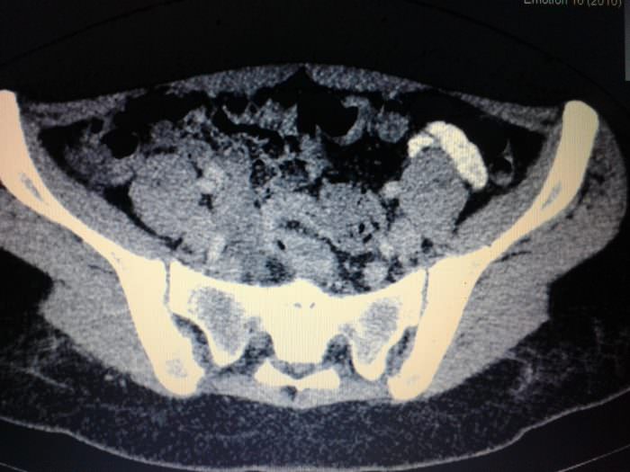 КТ с контрастным усилением