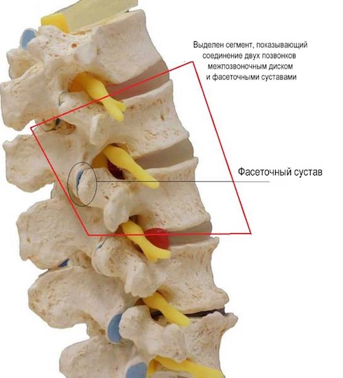 Спондилоартроз позвоночника