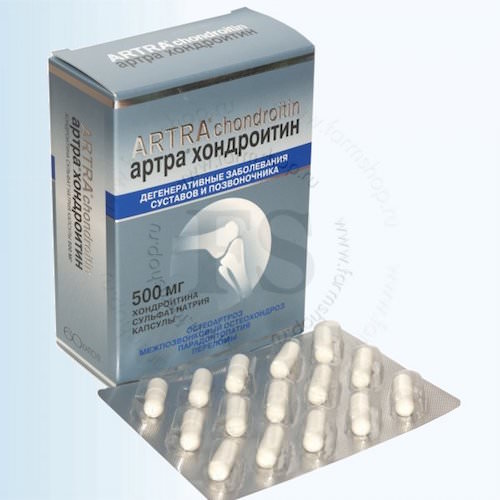 Спондилоартроз позвоночника