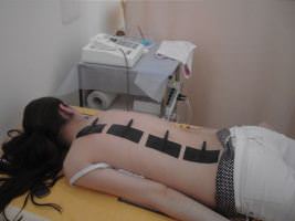 Лечение  спондилоартроза в пояснично-крестцовом отделе позвоночника