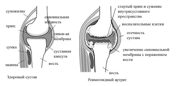 схема суставов