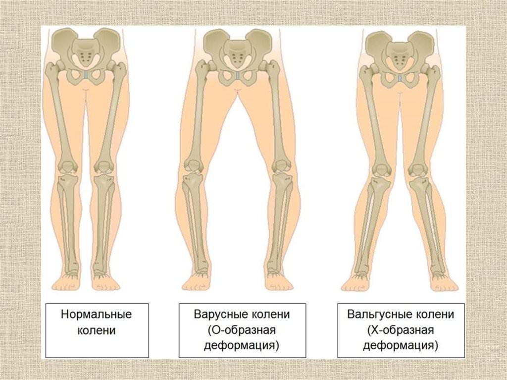 Рисунок
