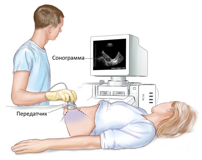 Сонограмма