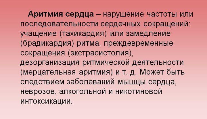 Понятие аритмии