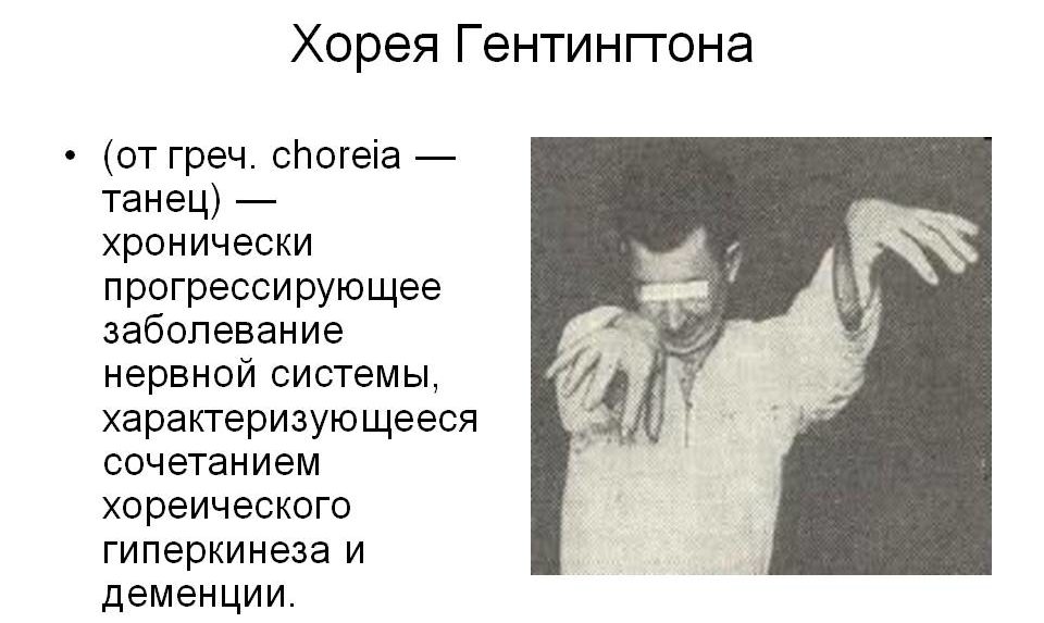 Хорея Гентингтона