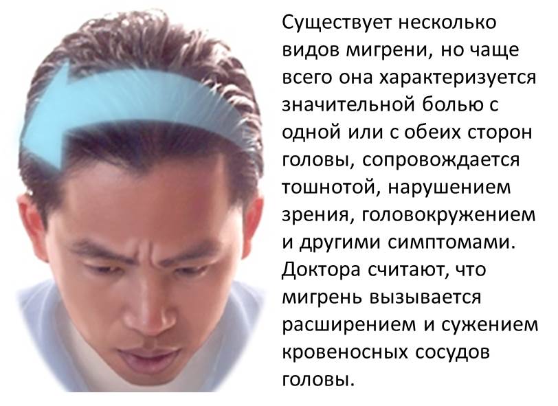 Особенности мигрени