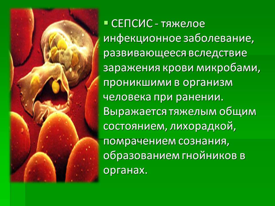 Сепсис