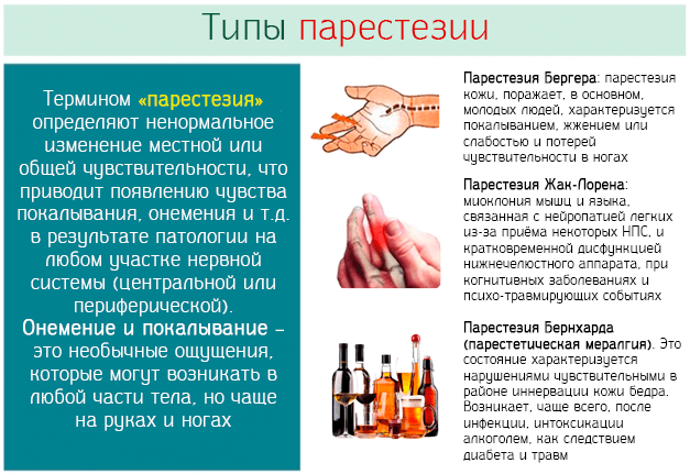 Парестезия