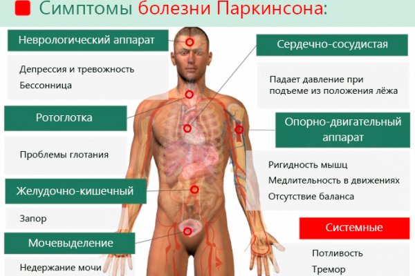Болезнь Паркинсона